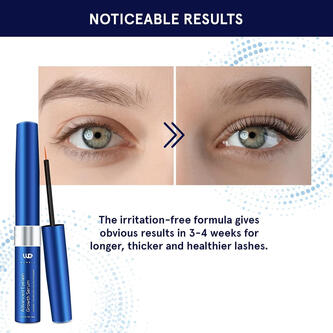 LÄNGERE UND DICKERE WIMPERN: Unser Wimpernserum ist vollgepackt mit fortschrittlichen, sanften und beruhigenden Inhaltsstoffen, die das Wimpernwachstum fördern und die Länge und Dichte der Wimpern erhöhen. Die Inhaltsstoffe des Wimpernserums dringen tief i